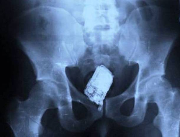 Cellular Phone X-Ray