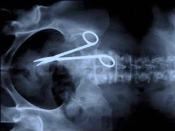 Scissor X-Ray