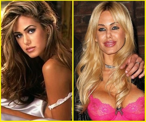 16 shauna-sand-plastic-surgery-before-and-after_tn