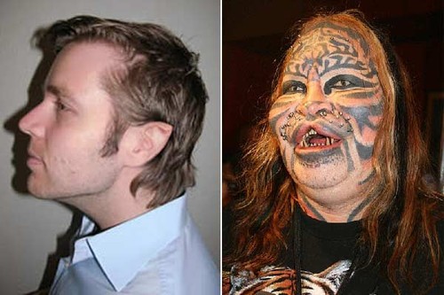 Plastic surgery gone wrong before and after picture of Dennis Avner