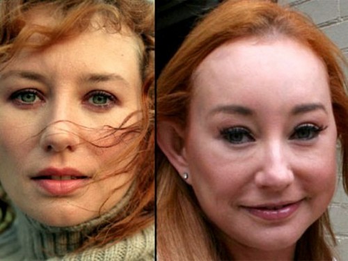 24 Tori-Amos-Before-and-After-Plastic-Surgery_tn