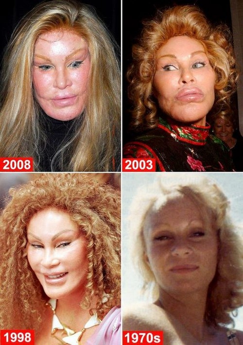The plastic surgery transformation of the woman known as "Cat woman"