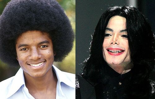 Plastic surgery before and after of Michael Jackson