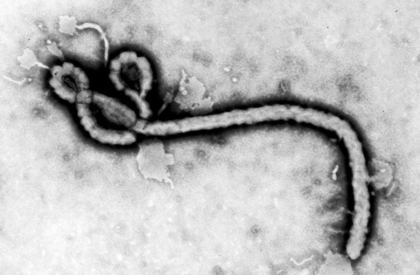25 Curious Facts About Ebola You Should Know