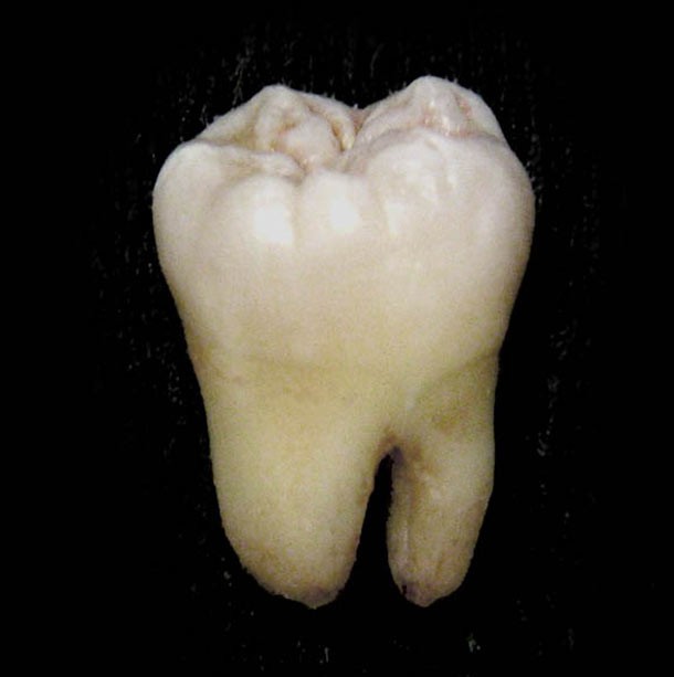 Tooth2
