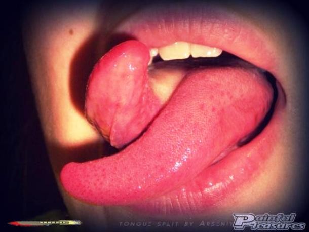 Tongue splitting
