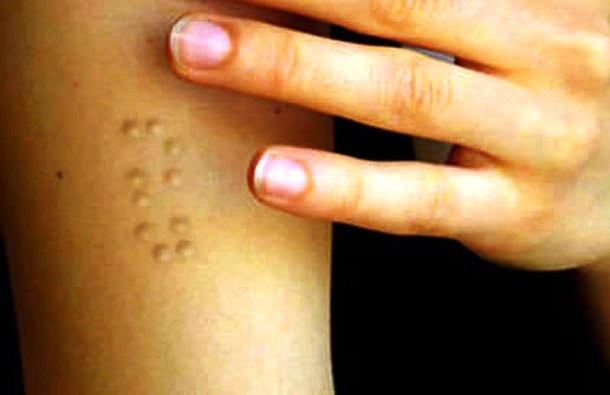 Braille subdermal implants