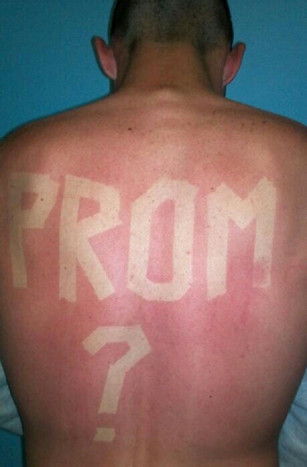 sunburn prom proposal