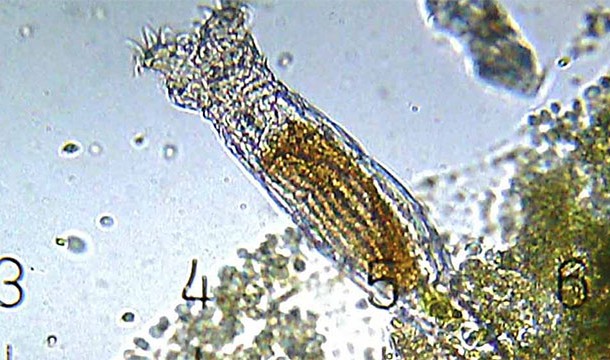 Bdelloid rotifers are microscopic creatures that have been exclusively female for over 80 million years. They reproduce by stealing the DNA of other animals