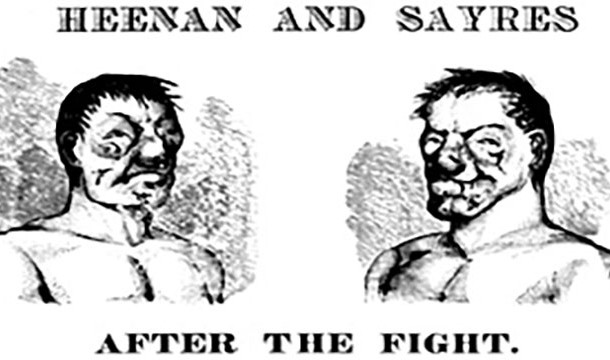 In 1860, John Heenan, a bareknuckle boxer, was beat so badly that an artist was hired to paint a picture of his face after the match. It recently sold for 3000 pounds