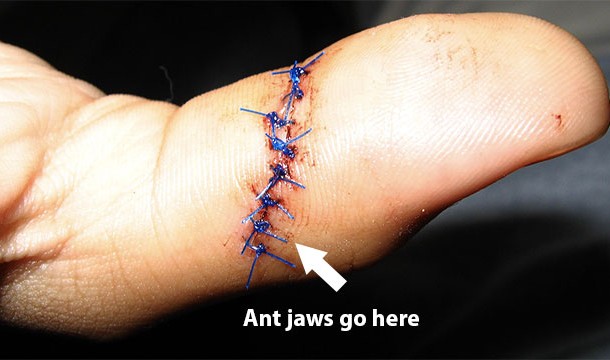 Ant jaws can be so strong that some indigenous tribes use them as sutures. They get the ant to bite down around the wound and then break off the ant's body