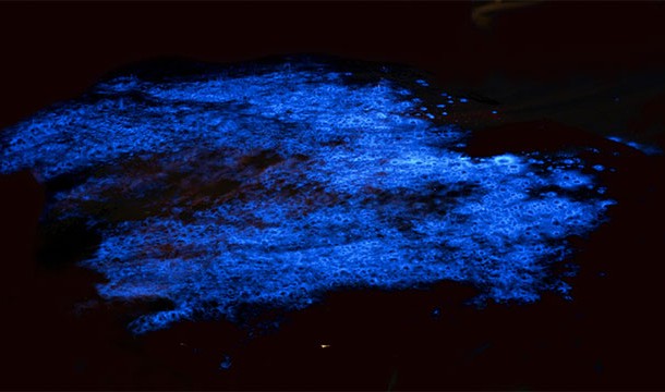 Some researchers are trying to create bioluminescent trees with the same enzymes found in jellyfish. This would provide a clean source of light for city streets at night