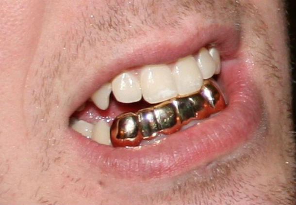 golden tooth