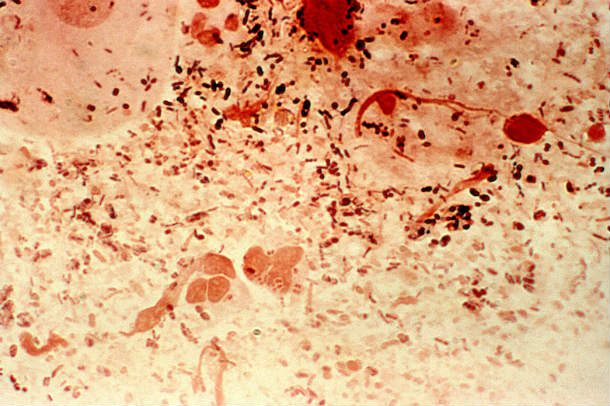 gram-negative-neisseria-gonorrhea-bacteria