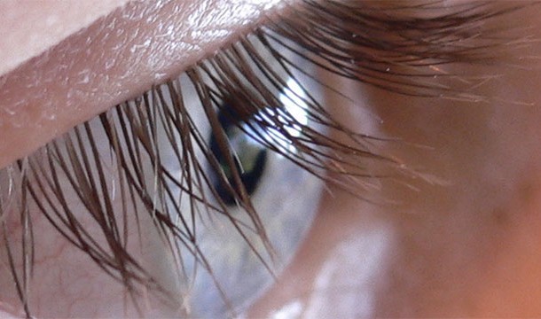 There are tiny mites living in your eyelashes