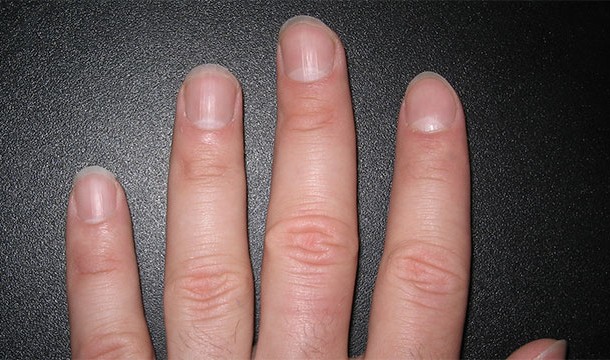There is enough iron in your body to make a nail that is almost 8 centimeters long