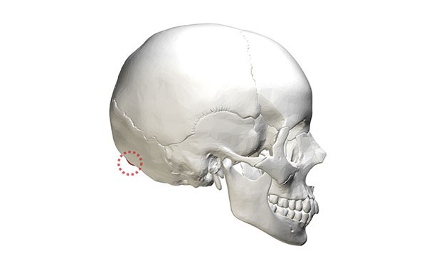 The external occipital protuberance (the bump on the back of your skull) is bigger in males than in females