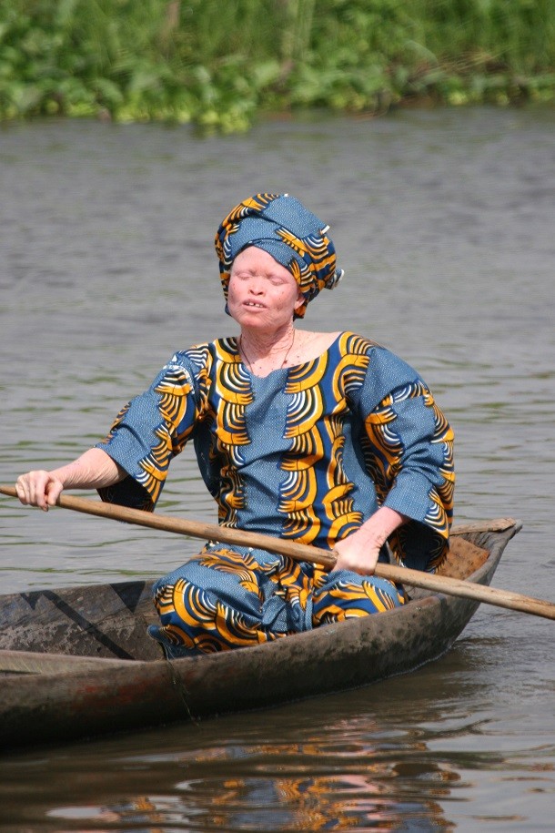 Albino_woman_in_canoe,_Benin