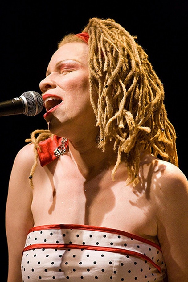 albinism singer mem nahadr