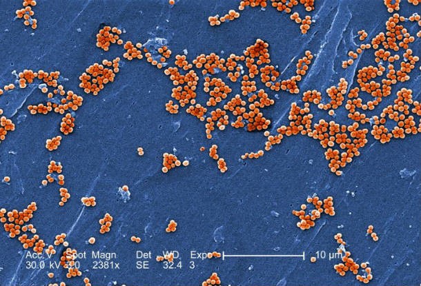electron-micrograph-depicted-numerous-clumps-of-methicillin-resistant-staphylococcus-aureus-bacteria