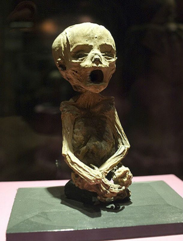 mummy fetus