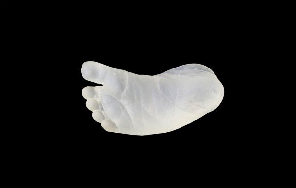 baby foot cast