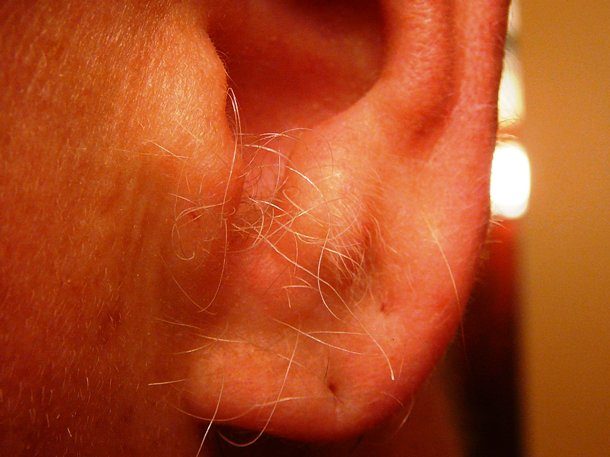 ear hair