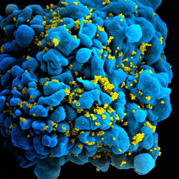 HIV infected t cell