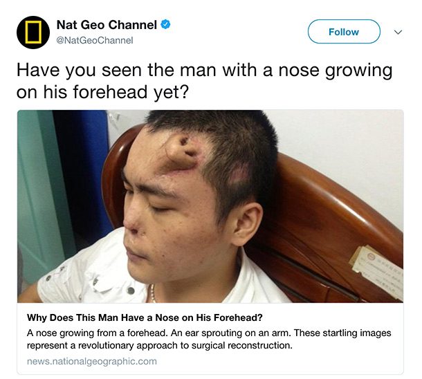 nose on head