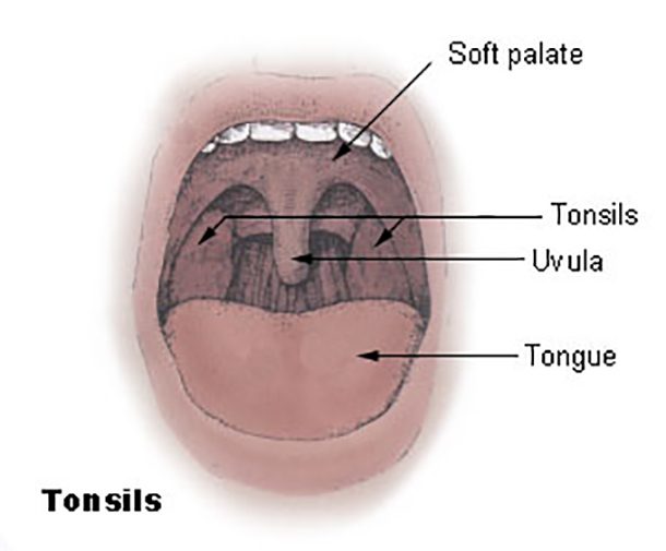 Tonsils_diagram