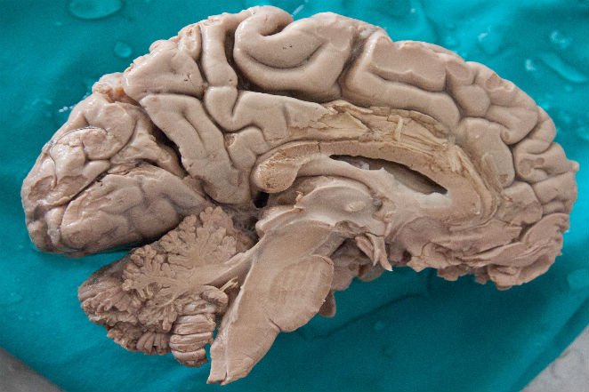Human_Brain_Dissected