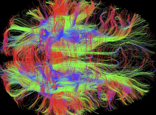 neurons in brain