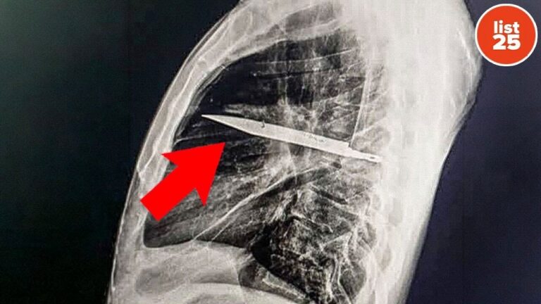 25 More Creepy Facts to Send Shivers Down Your Spine